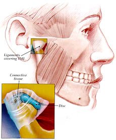 Oral Cancer